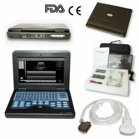 Digital Laptop Machine Ultrasound Scanner Convex 3.5Mhz Probe Abdominal For Human Use (Option: CMS600P2)